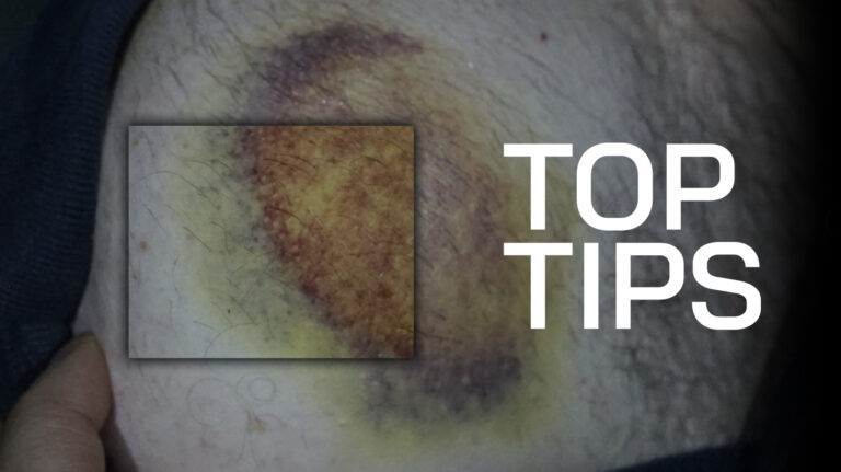 Top Tips: Photographing Highly Reflective Surfaces with the Crime-lite AUTO